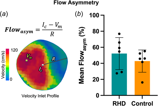 Blood flow asymmetry (a) at the inlet was measured for both groups at peak systole using subject-specific velocity profiles and (b) mean values were summarized. Flowasym = flow asymmetry; Ic = inlet centroid coordinates; Vm = maximum velocity coordinates; and R = radius.