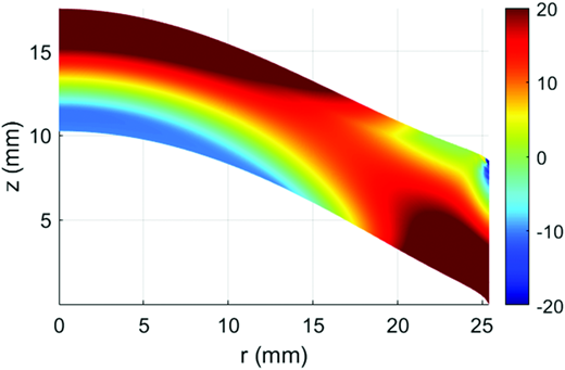 Finite element prediction of the first principle stress under 100 cm H2O static pressure applied on its bottom surface. This is a cross section of the axisymmetrically stressed phantom from its center (left) to its fixed perimeter (right). Color scale is in kPa.